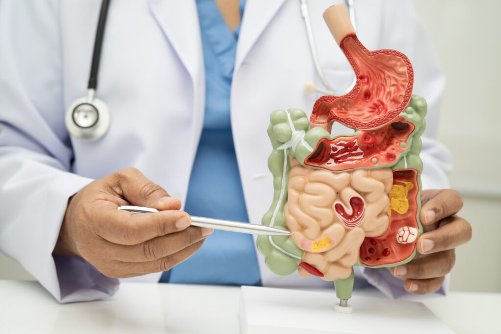 Digestive Issues